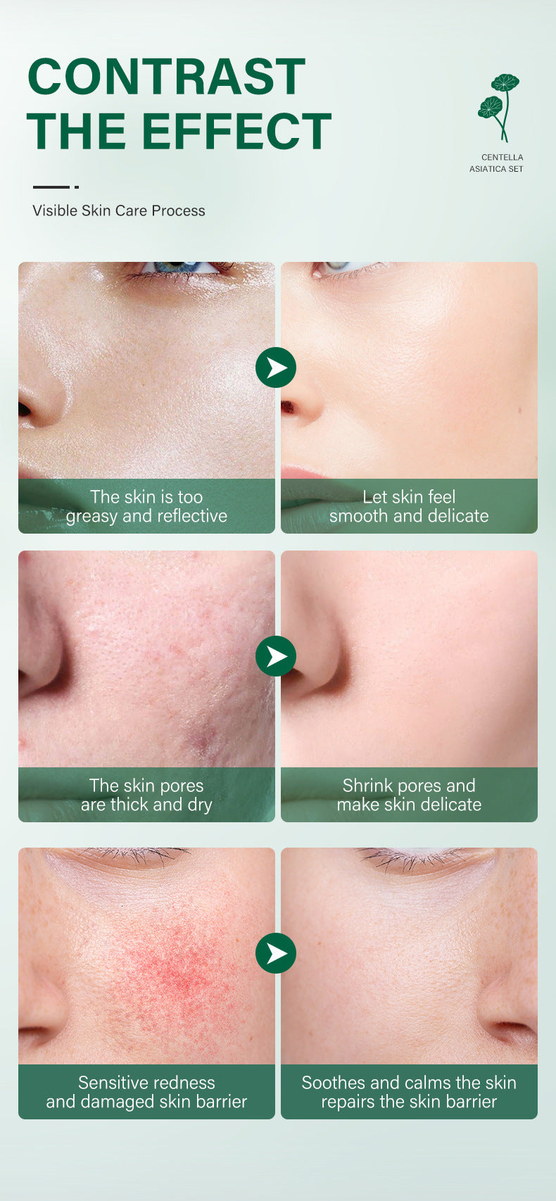 Snow Grass Set Combination Facial Skincare Cosmetics